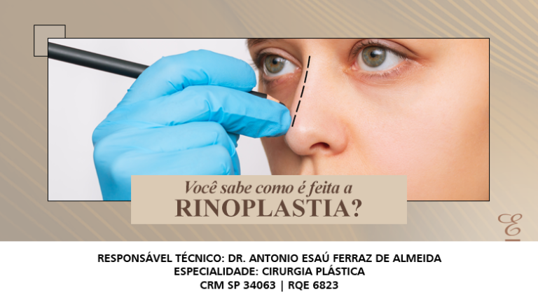 COMO É FEITA A RINOPLASTIA E QUAIS SÃO OS CUIDADOS NECESSÁRIOS Dr Esaú