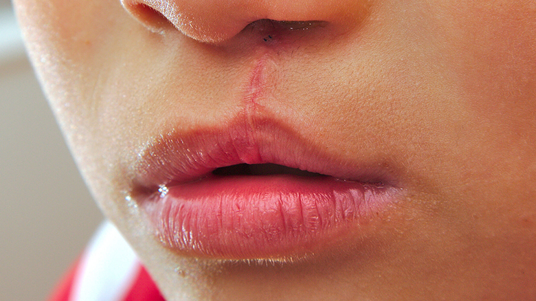 Cirurgia Plástica Reparadora