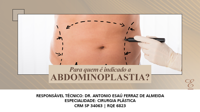 Quais S O As Principais Indica Es Para A Abdominoplastia Dr Esa